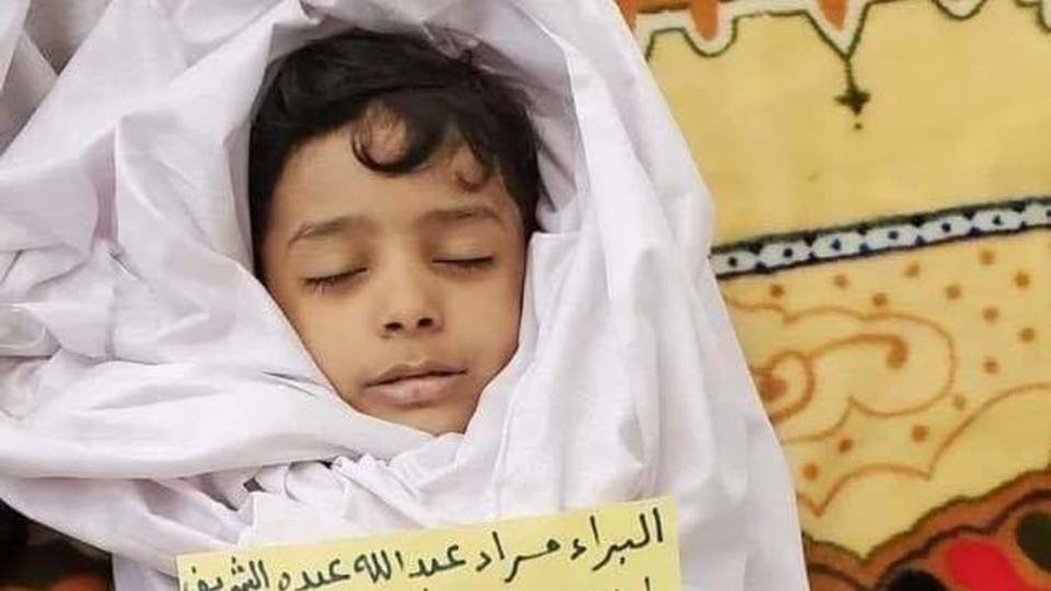 الطفل البراء مراد الشريف (6 سنوات) فارق الحياة متأثرا بإصابته إثر قصف الحوثيين